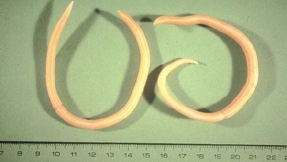 Roundworms - cacing anu manifest sorangan kalawan kacapean sarta batuk